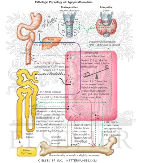 Pathophysiology of Hypoparathyroidism