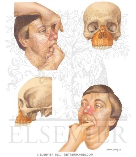 Watermarked preview of unlabeled image: Facial Trauma: Examination for Mid-Face Fracture