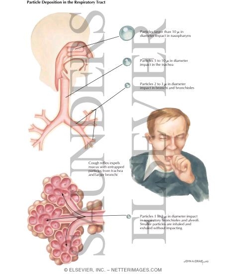 Watermarked preview of labeled image: Nosocomial Infections: Particle Deposition In the Respiratory Tract