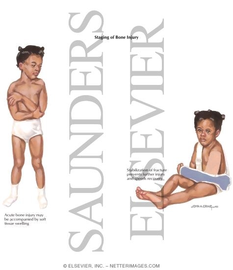 Watermarked preview of labeled image: Child Abuse: Staging of Bone Injury