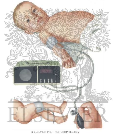 Measurement Of Blood Pressure In Infants Ultrasound Method