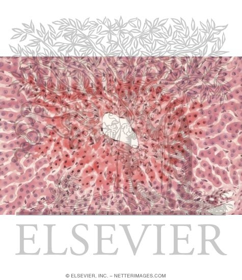 Centrilobular Hepatic Necrosis