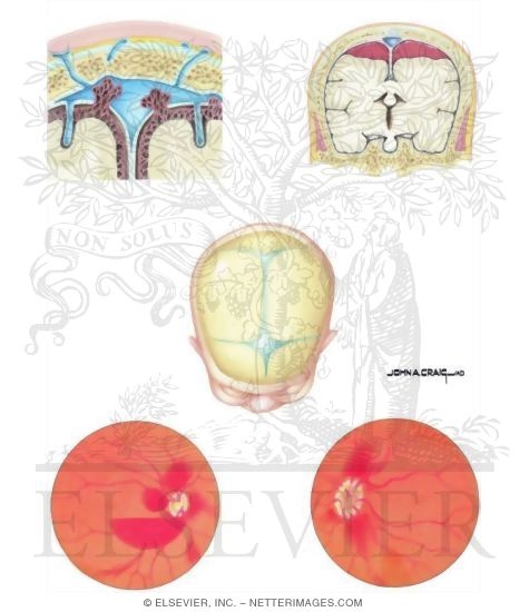 Watermarked preview of unlabeled image: Child Abuse: Head Trauma and Head Injury