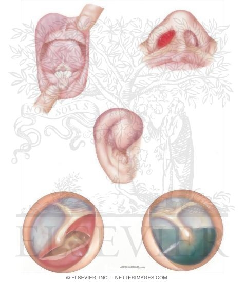 Watermarked preview of unlabeled image: Child Abuse: Injuries to the Ears, Nose, and Mouth