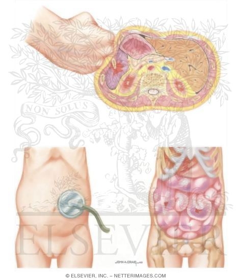 Watermarked preview of unlabeled image: Child Abuse: Abdominal Trauma