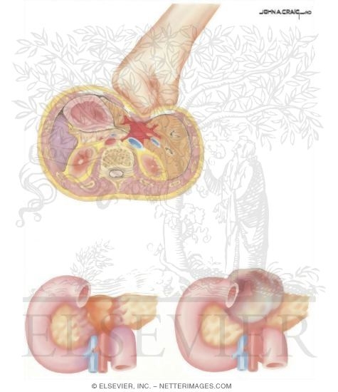 Watermarked preview of unlabeled image: Child Abuse: Abdominal Trauma