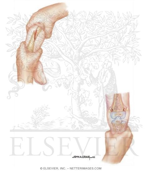 Watermarked preview of unlabeled image: Child Abuse: Skeletal Injuries
