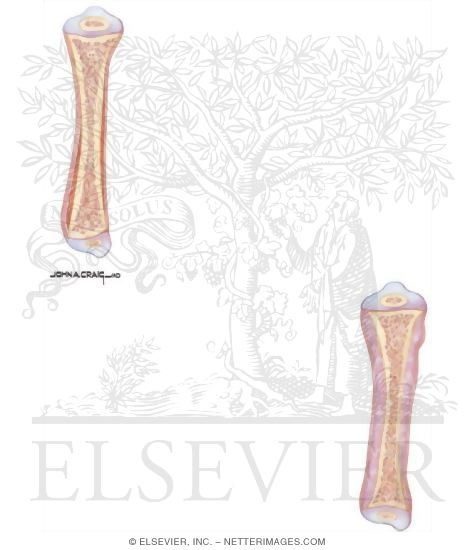 Watermarked preview of unlabeled image: Child Abuse: Bone Trauma
