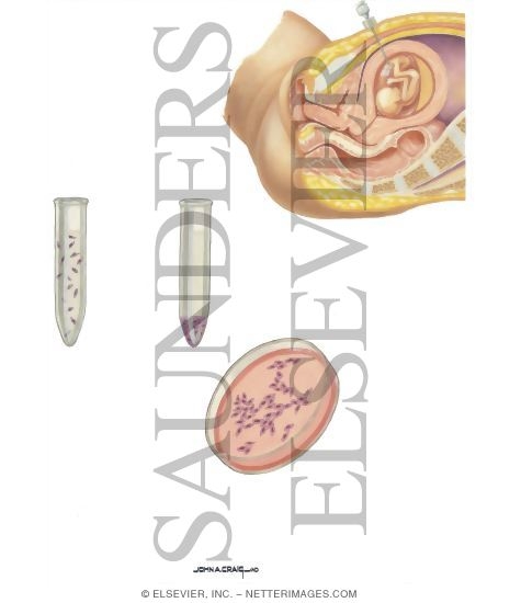 Watermarked preview of unlabeled image: Birth Defects: Antenatal Diagnosis
