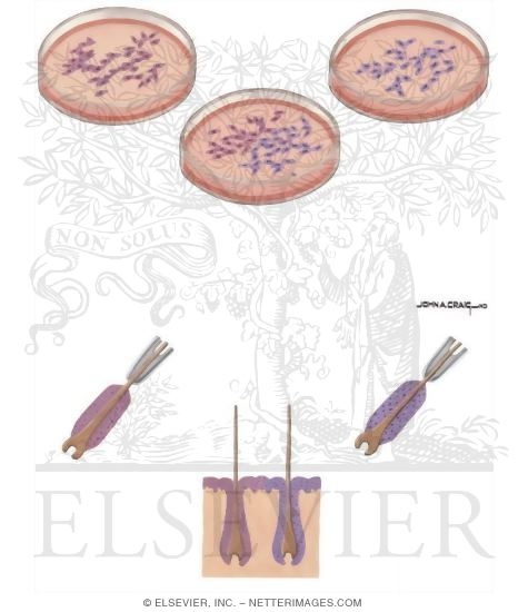 Watermarked preview of unlabeled image: Birth Defects: Heterozygote Detections