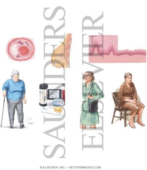 Health Maintenance In Women: Ages 40 - 64