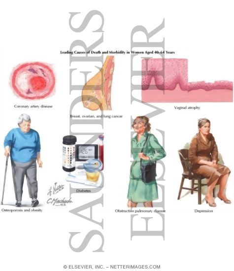 Watermarked preview of labeled image: Health Maintenance In Women: Ages 40 - 64