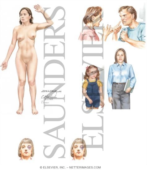 Abuse: Physical and Sexual
