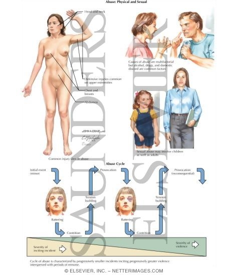 gynecology and sexual abuse gynecology and sexual abuse