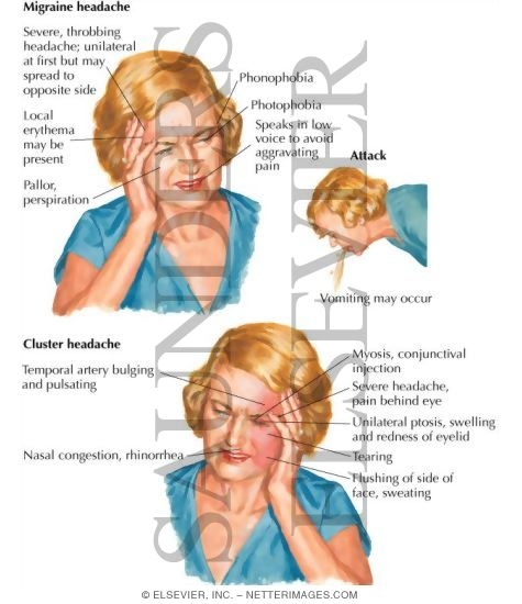 Watermarked preview of labeled image: Headache: Tension, Cluster and Migraine