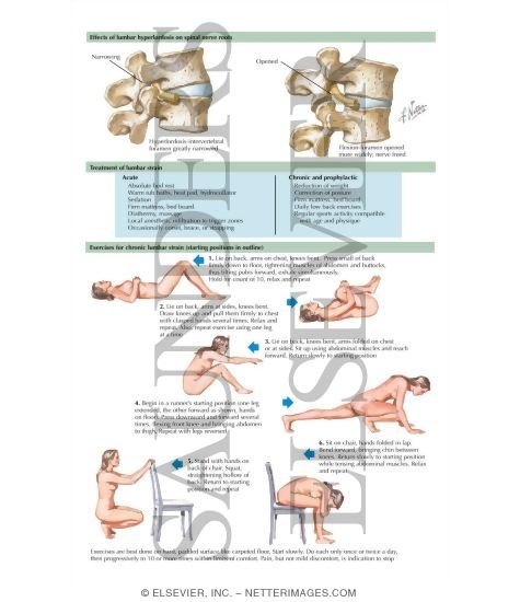 Watermarked preview of labeled image: Low Back Pain