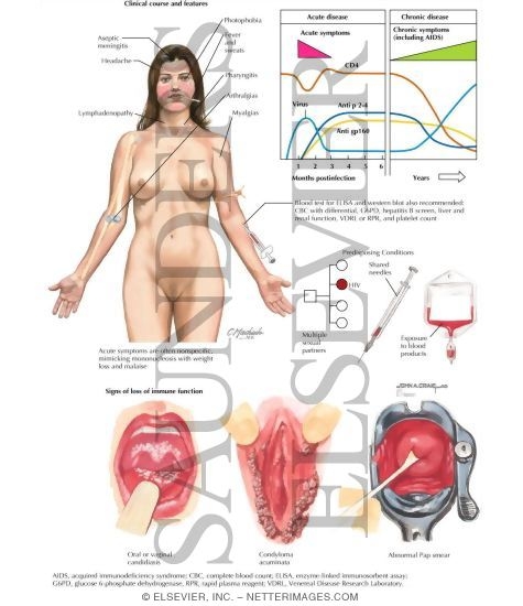 Sexually Transmitted Infections: Human Immunodeficiency Virus