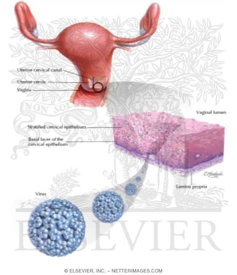 Sexually Transmitted Infections: Human Papillomavirus (HPV)
