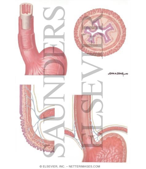 Hiatus Hernia: Anatomy of Esophagus and Phrenoesophageal Membrane
