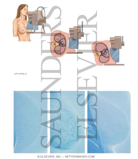 Watermarked preview of unlabeled image: Mammography