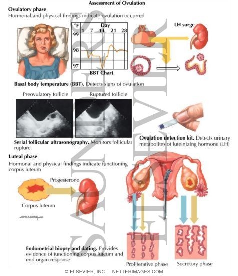 Anovulation