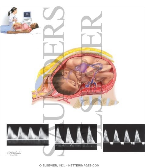 Watermarked preview of unlabeled image: Doppler Flow Studies (Doppler Velocimetry)