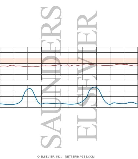 Fetal Heart Rate Testing: Bradycardia
