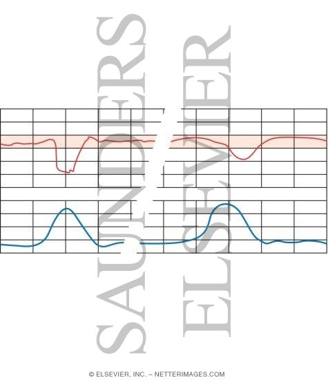Watermarked preview of unlabeled image: Fetal Heart Rate Testing: Periodic Changes