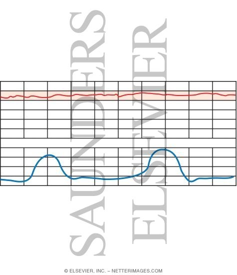 Watermarked preview of unlabeled image: Fetal Heart Rate Testing: Tachycardia