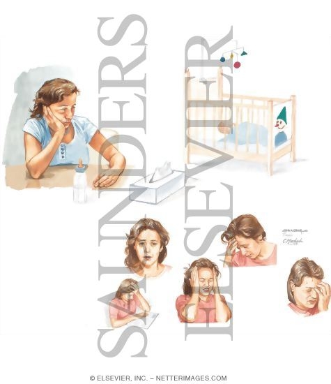 Watermarked preview of unlabeled image: Depression: Postpartum