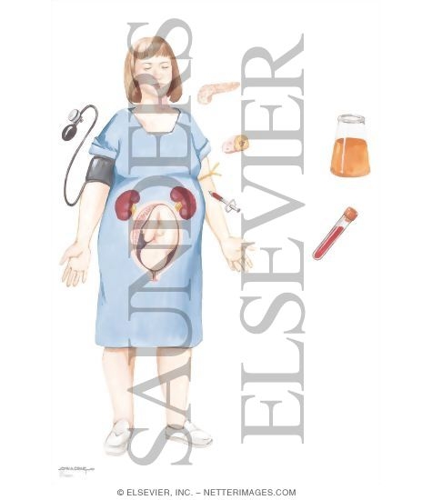 Watermarked preview of unlabeled image: Diabetes Mellitus In Pregnancy