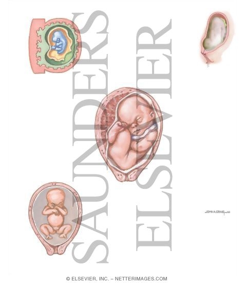 Watermarked preview of unlabeled image: Oligohydramnios