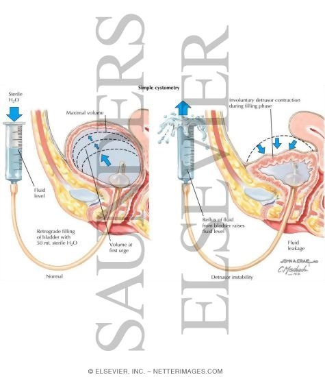 Watermarked preview of labeled image: Urodynamic Testing: Simple