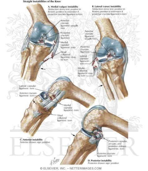 Valgus, Varus, Anterior and Posterior Instabilities of the Knee