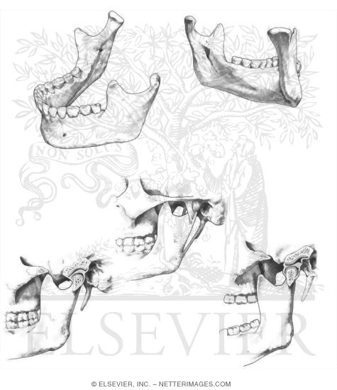Mandible and Temporomandibular Joint