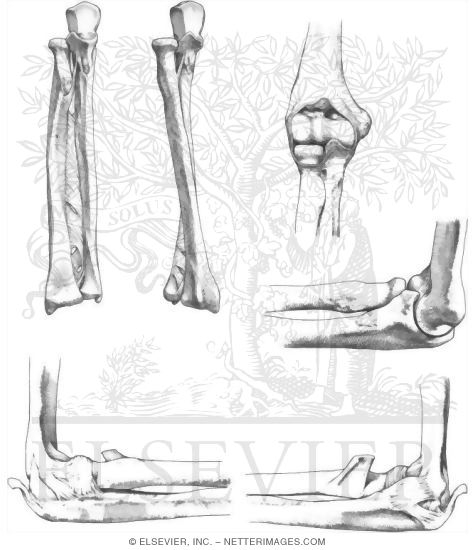 Forearm and Elbow Joint