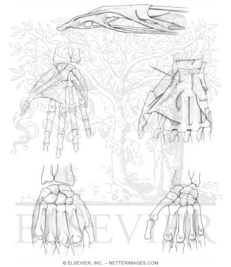 Intrinsic Hand Muscles