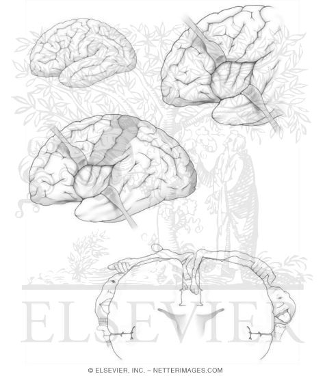 Watermarked preview of unlabeled image: Cerebrum