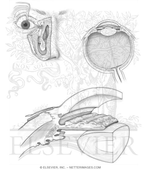 Visual System I