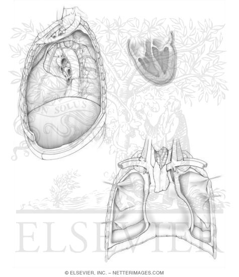 Heart I