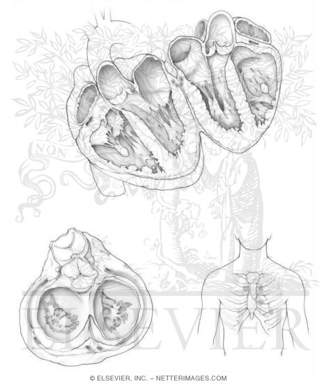 Heart II