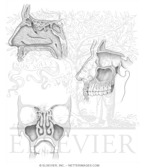 Paranasal Sinuses