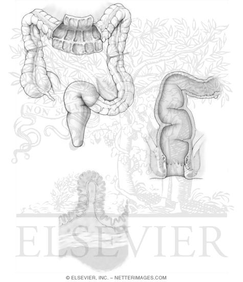 Large Intestine Anatomy Coloring Book Pdf Netters