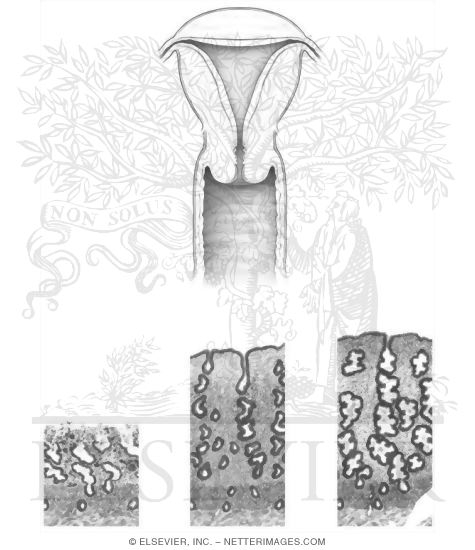Uterus and Vagina