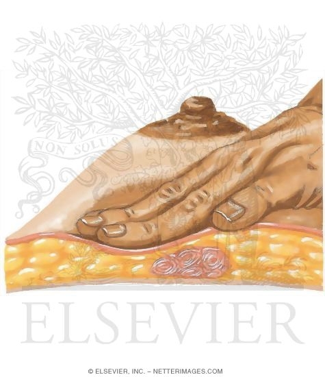 Watermarked preview of unlabeled image: Palpation of the Breast