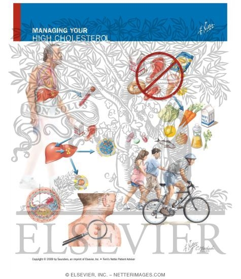 Watermarked preview of unlabeled image: Managing Your High Cholesterol