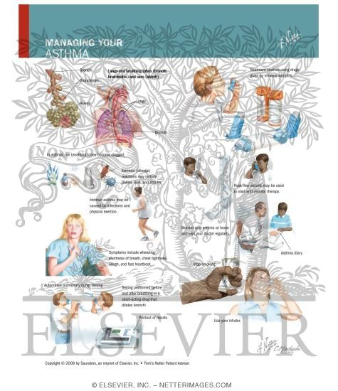 Watermarked preview of unlabeled image: Managing Your Asthma