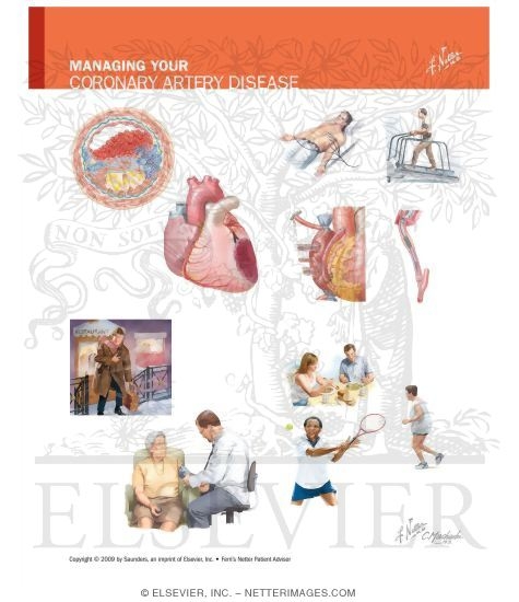 Watermarked preview of unlabeled image: Managing Your Coronary Artery Disease