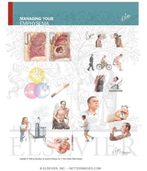 Watermarked preview of unlabeled image: Managing Your Emphysema