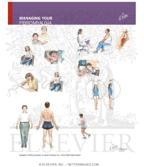 Watermarked preview of unlabeled image: Managing Your Fibromyalgia